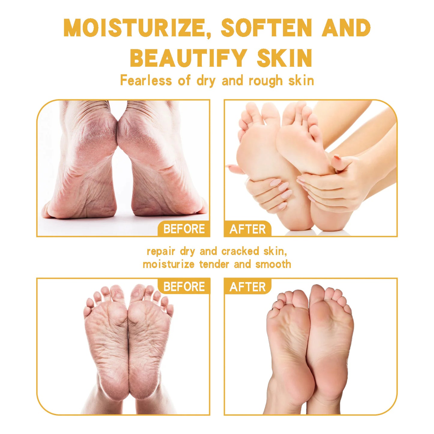 WÉSAMÉ Cream For Chapped Skin Foot Care Moisturizing And Anti-cracking