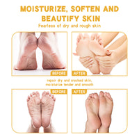 WÉSAMÉ Cream For Chapped Skin Foot Care Moisturizing And Anti-cracking